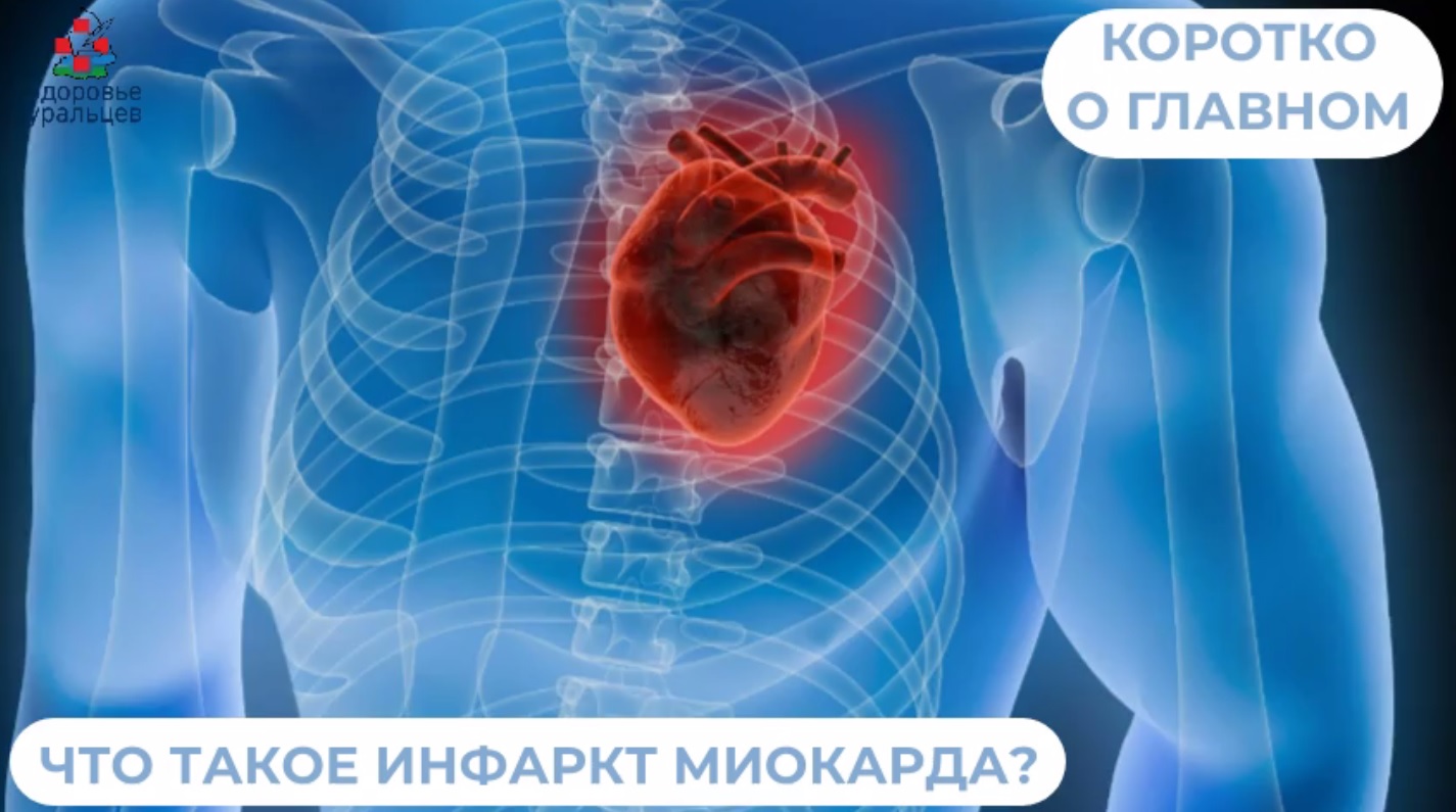 Что такое инфаркт миокарда? 
