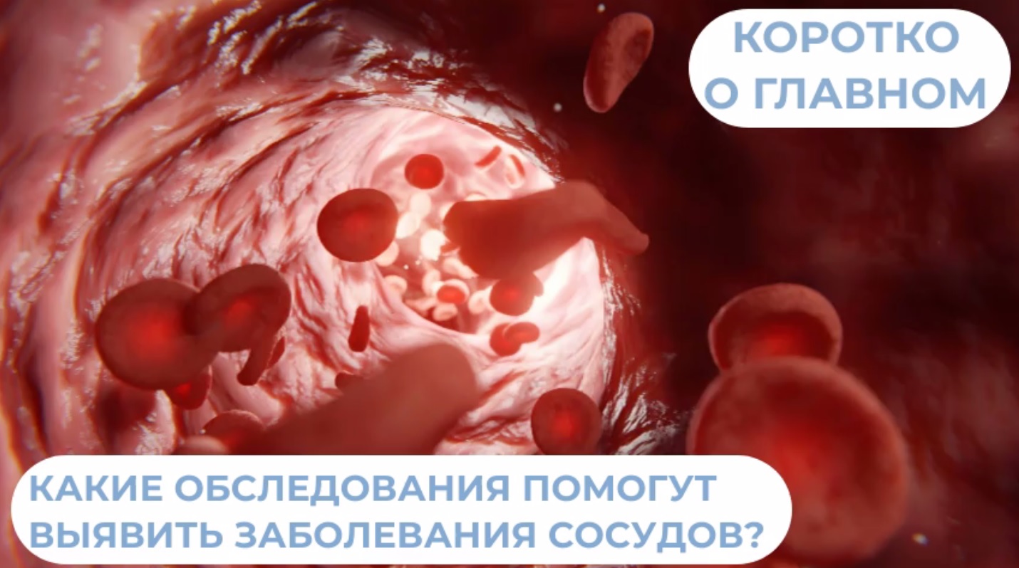Какие обследования помогут выявить заболевания сосудов?