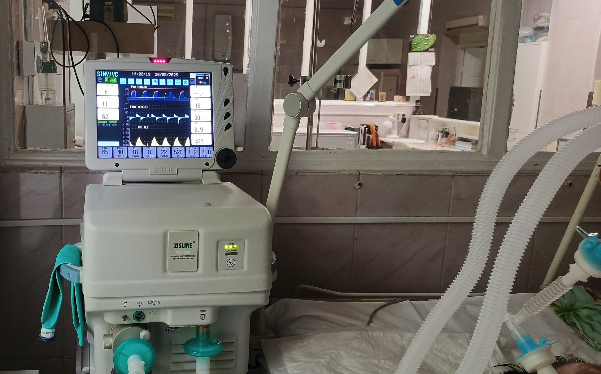 Два месяца на ИВЛ: свердловские врачи спасли пациента с тяжёлой черепно-мозговой травмой