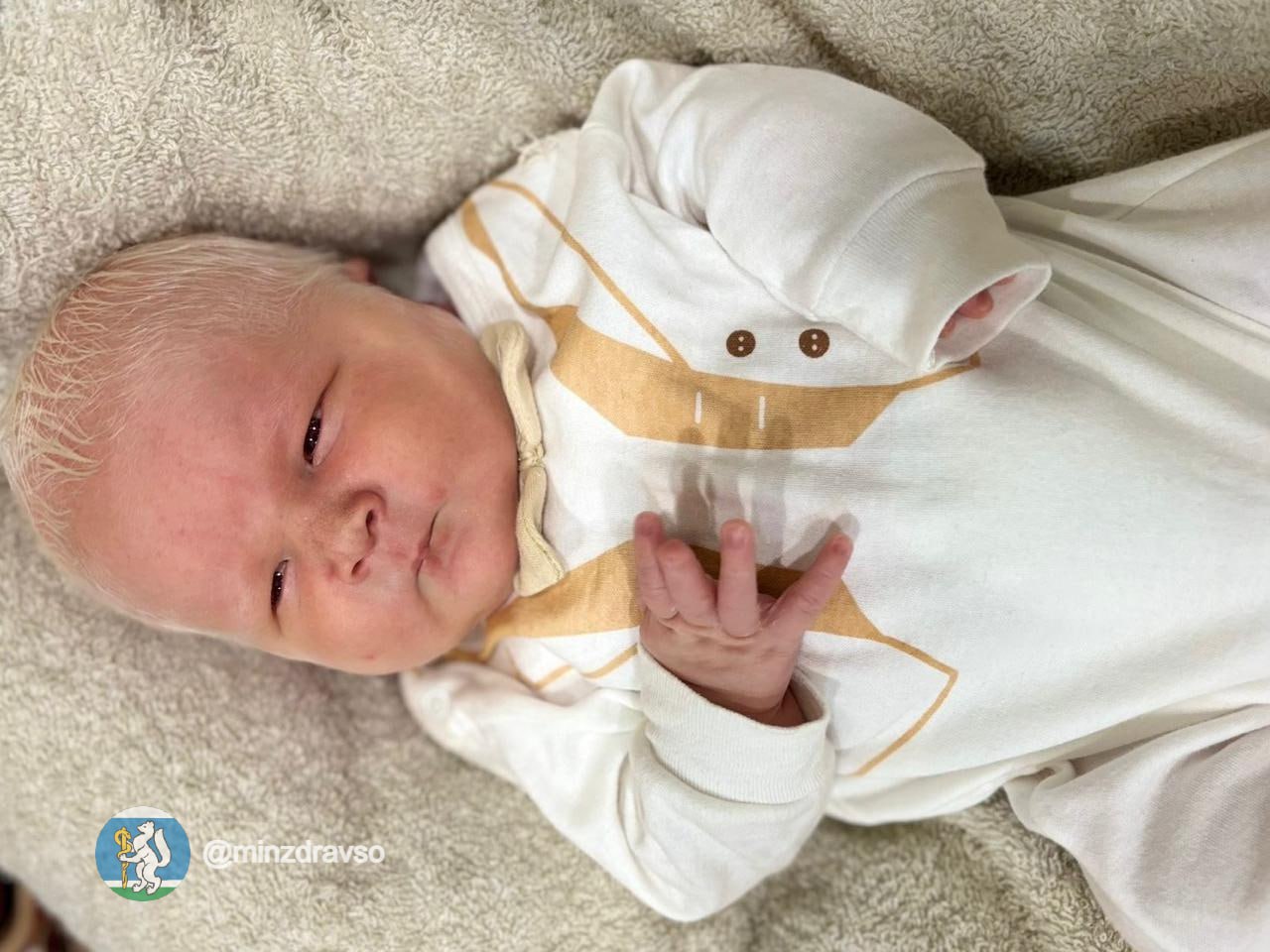 Мальчик-альбинос с глазами цвета граната родился в Нижнем Тагиле