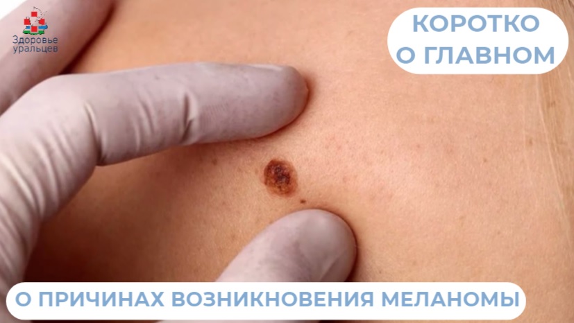 О причинах возникновения меланомы