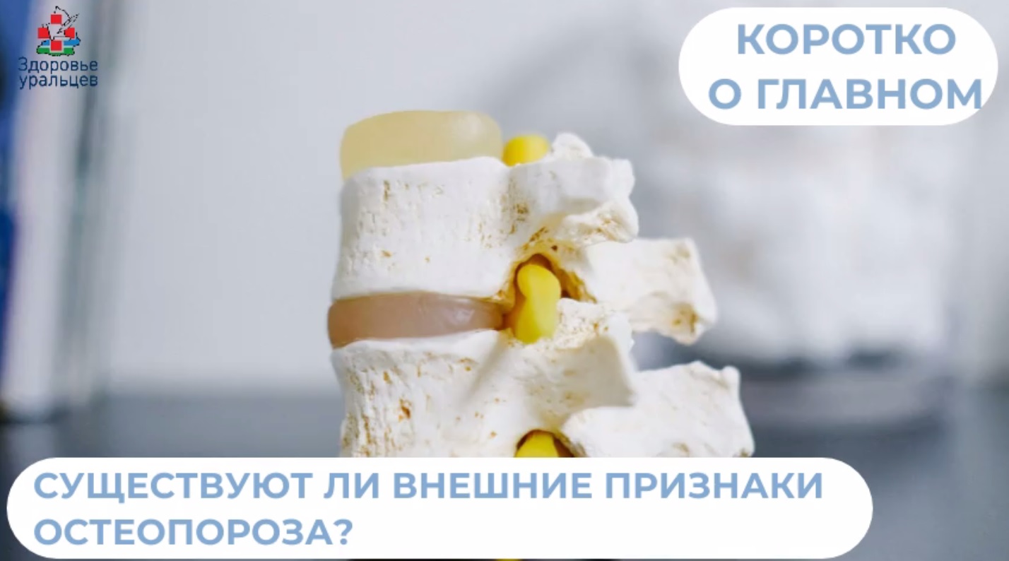 Существуют ли внешние признаки проявления остеопороза?