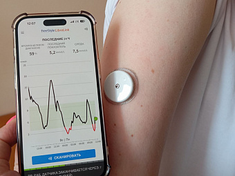 Новые технологии позволяют уральцам с сахарным диабетом непрерывно отслеживать уровень глюкозы в режиме онлайн