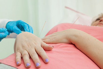 Иглорефлексотерапия. Восточная практика в арсенале уральских медиков