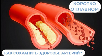 Как сохранить здоровье артерий?
