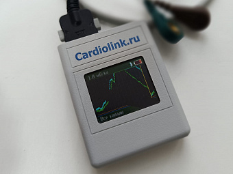 Благодаря аппарату для холтеровского мониторирования четырём пациентам Махнёвской больницы установлены кардиостимуляторы