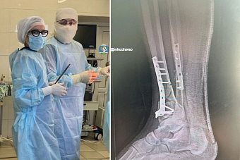 Врачи Каменска-Уральского возвращают пациентов к активной жизни после серьёзных ДТП