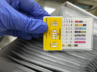 Свердловские наркологи начали тестировать юных уральцев на склонность к зависимостям и употребление запрещённых веществ