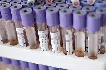 Свердловские медики усилили контроль за эффективностью лечения уральцев с хроническими психическими расстройствами